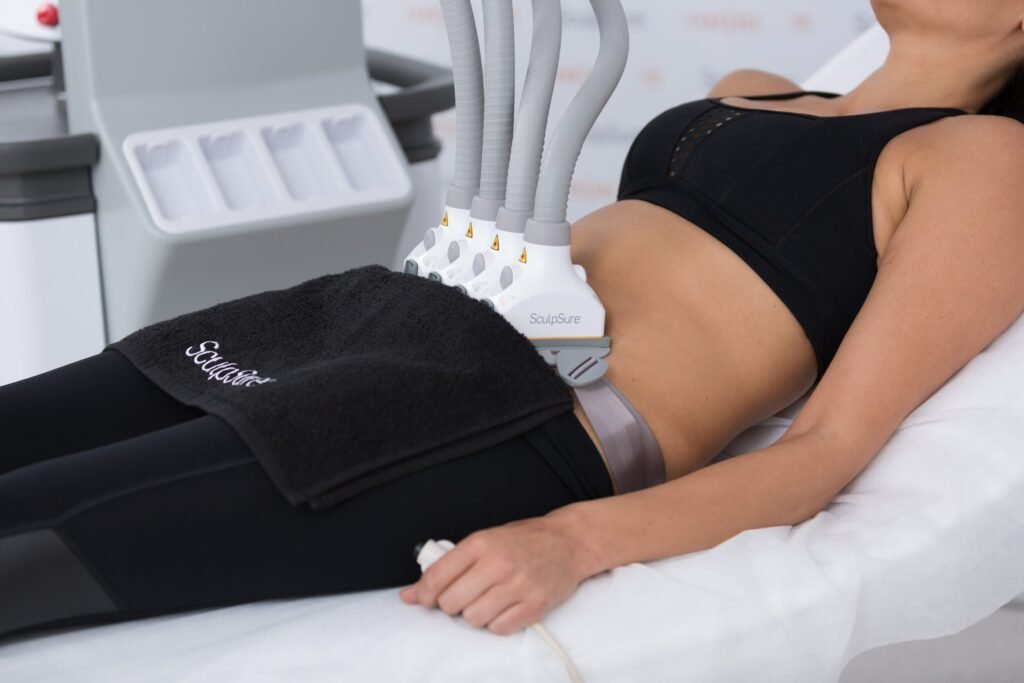Woman undergoing SculpSure treatment with applicators on abdomen, showcasing non-invasive fat removal procedure at Shore MedSpa.