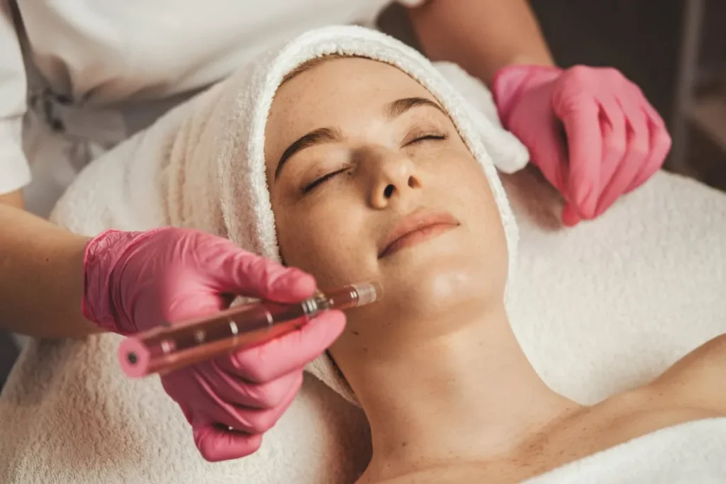 Woman receiving microneedling treatment with a device, performed by a technician wearing pink gloves, in a serene spa setting.
